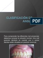 Clasificación de Angle