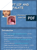 Cleft Lip and Palate