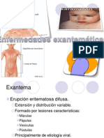 Enfermedades Exantematicas