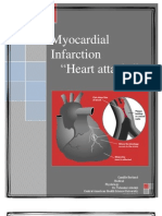 Myocardial Infarction "Heart Attacks"