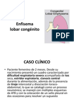 Enfisema Lobar Congénito