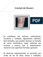 Enfermedad de Bowen