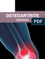 Osteoartrite - SBR