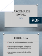 Sarcoma de Ewing