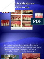 Tipos de Colgajos en Periodoncia