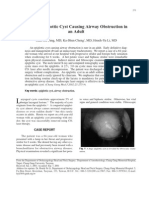 A Huge Epiglottic Cyst Causing Airway Obstruction in An Adult