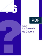 Artrosisi de Cadera