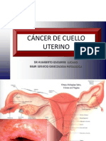 Ca Cervix