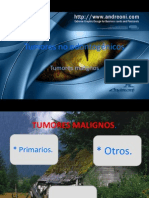 Tumores No Odontogenicos