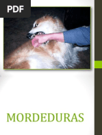 Mordeduras