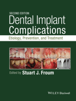 Dental Implant Complications: Etiology, Prevention, and Treatment