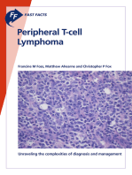 Fast Facts: Peripheral T-cell Lymphoma: Unraveling the Complexities of Diagnosis and Management