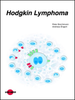 Hodgkin Lymphoma