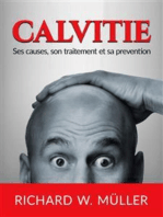 Calvitie (Traduit): Ses causes, son traitement et sa prevention