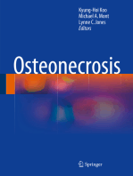 Osteonecrosis