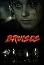 Bruises (2018)