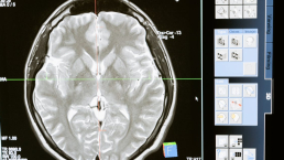 Amphetamine exposure effect on embrogenesis