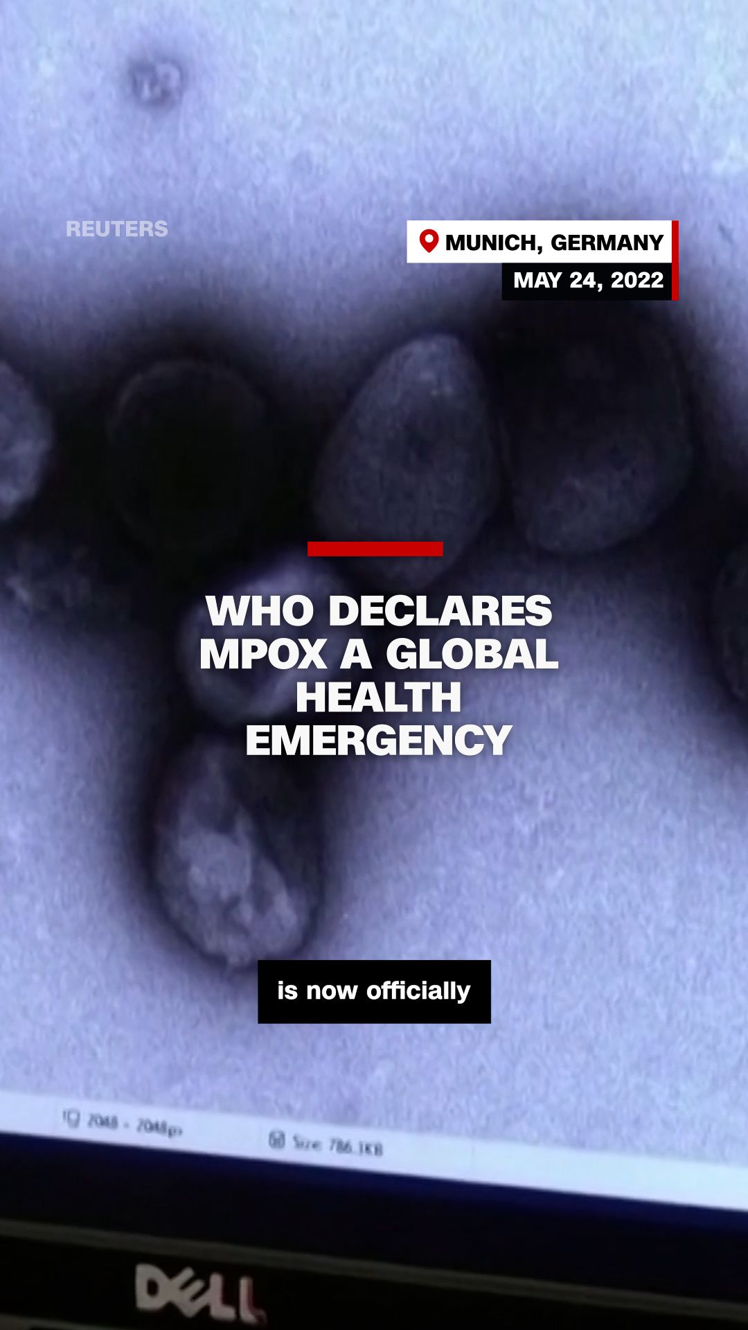 109335_mpox outbreak emergency v2.00_00_02_16.Still001.jpg