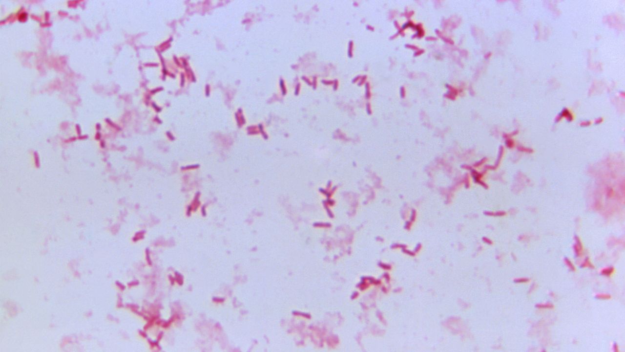 Under a magnification of 1125X, this Gram-stained photomicrograph depicted numerous, Gram-negative, rod-shaped, <em>Yersinia pestis</em> bacteria, formerly known as <em>Pasteurella pestis</em>.