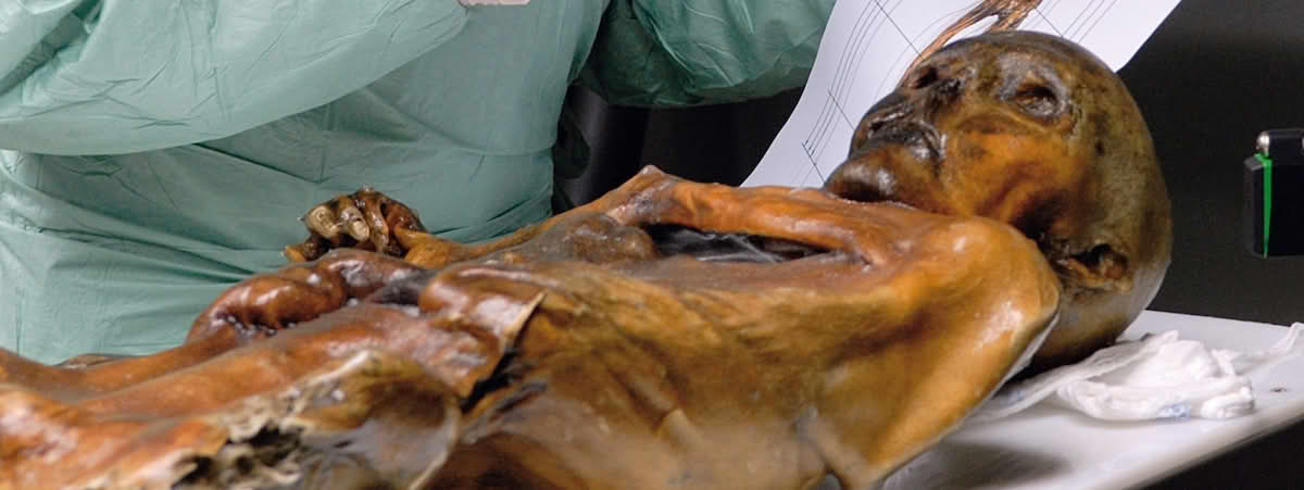 Ötzi