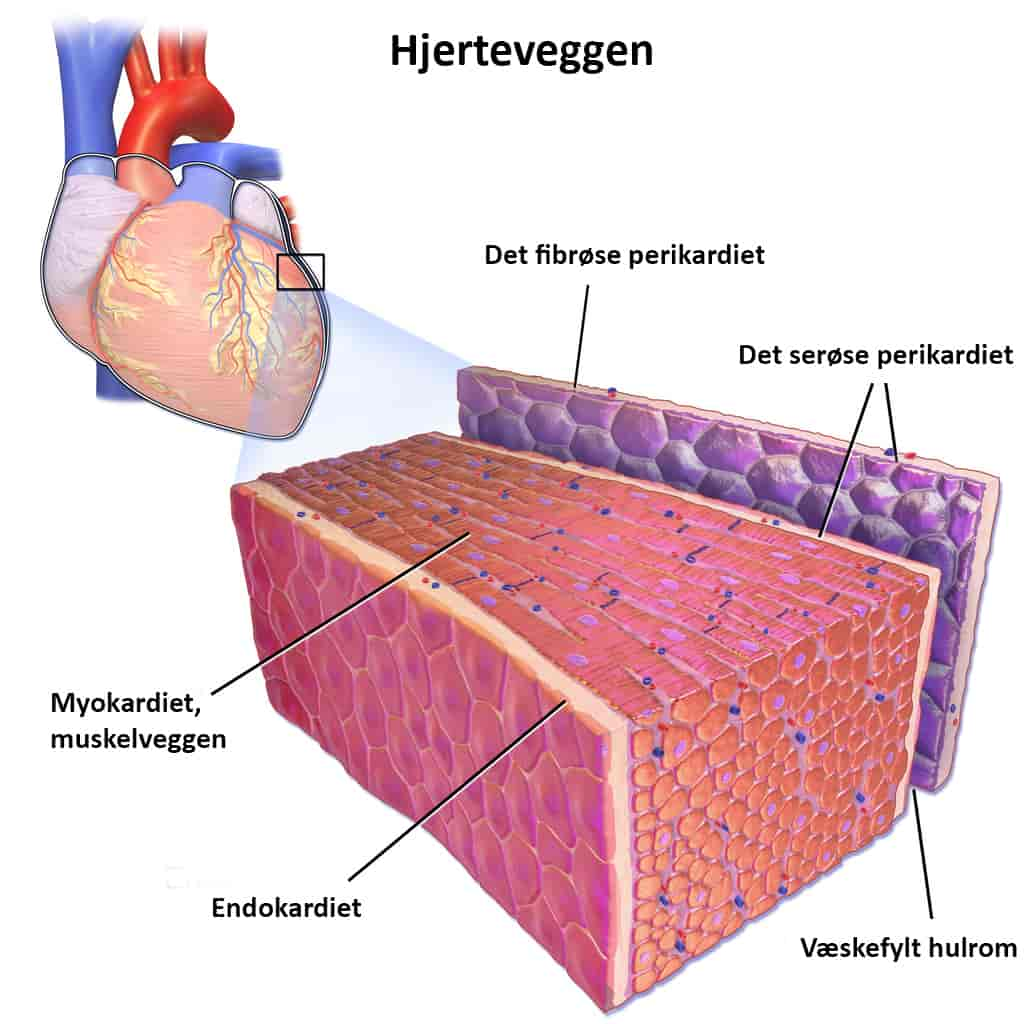 Hjerteveggen