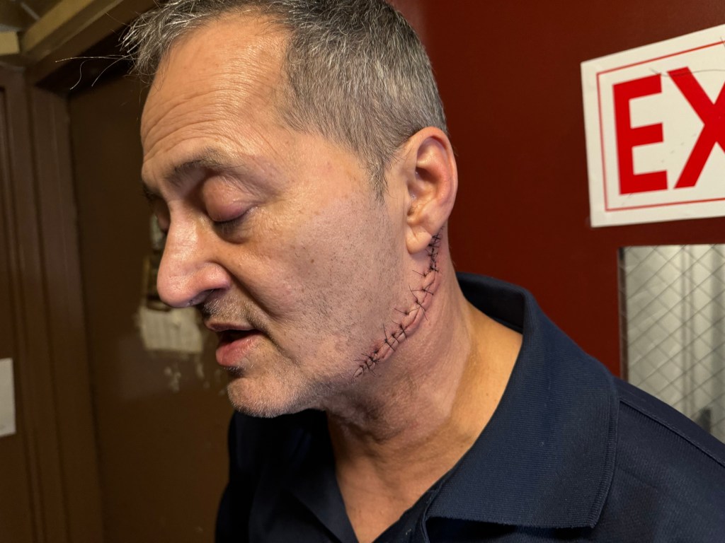 John Mach with stitches on his neck showing his injuries to a reporter