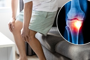 Middle-aged man holding knees, pain in kneecap or muscles around knee joint,patella friction against the thigh bone,standing up with difficulty,disease of Runner's knee or Patellofemoral pain syndrome