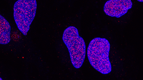 Imagen al microscopio con fluorescencia de células en presencia del nuevo compuesto fotosensibilizante DBI.