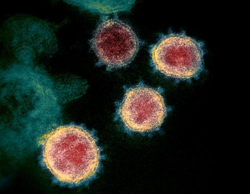 Imagem do coronavírus visto em um microscópio eletrônico.  — Foto:  NIAID/Divulgação