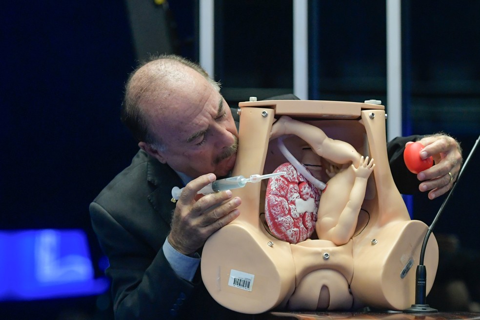 Senado teve debate sobre assistolia fetal, em que só ouviu posicionamento antiaborto; na foto, o deputado Dr. Zacharias Calil (União-GO) — Foto: Geraldo Magela/Agência Senado