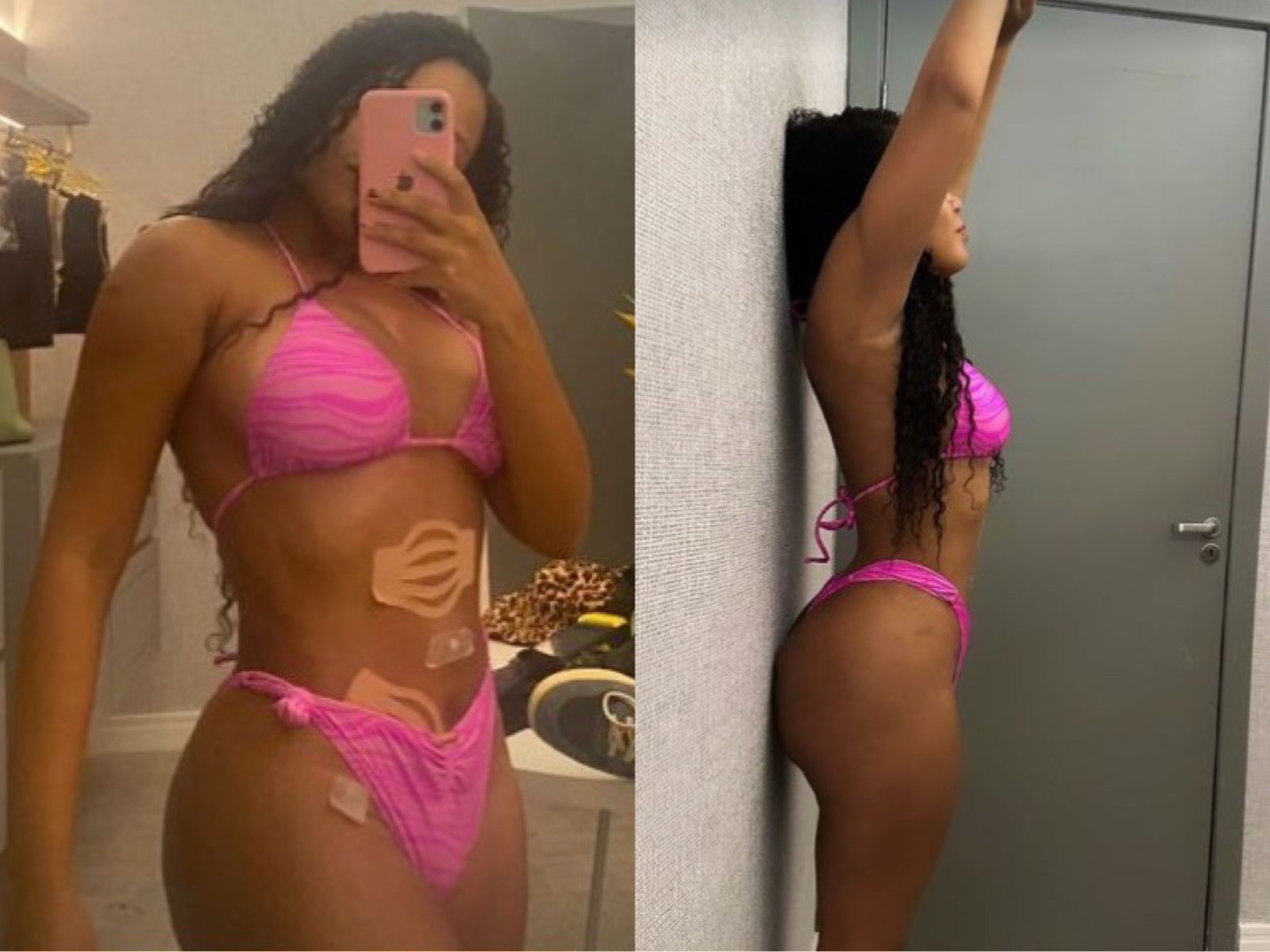 Thalyta fez lipoaspiração na barriga e preenchimento nos glúteos