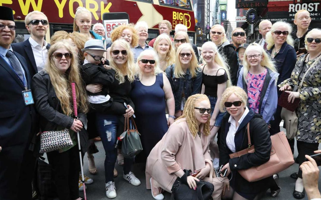 Raising awareness about albinism around the world