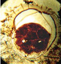 L'embrió potencial més antic conegut, preservat dins un acritarc acantomòrfic.