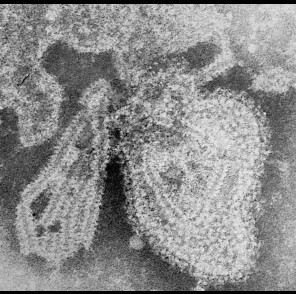 볼거리바이러스의 투과전자현미경 사진