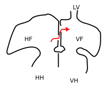 Foramen ovale