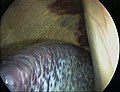 一匹馬的脾臟腹腔鏡圖像（紫灰相間器官）