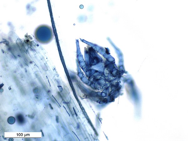 Soil arthropod takes Trypan blue stain