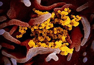 ויריוני SARS-CoV-2 (בצהוב) מגיחים מתא אנושי (בתרביות תאים במעבדה)