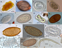 Rondwormparasieteneitjes en een Strongyloides stercoralis aaltje