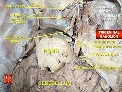 Trigeminal ganglion.jpg