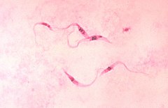 Description de l'image Trypanosoma_cruzi_crithidia.jpeg.