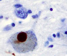 Several brain cells stained in blue. The largest one, a neurone, with an approximately circular form, has a brown circular body inside it. The brown body is about 40% the diameter of the cell in which it appears.الخصائص