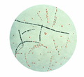 Thumbnail for Bacillus anthracis