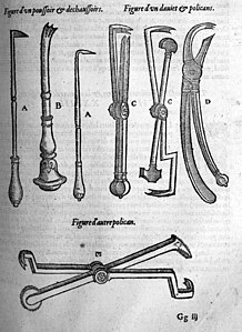 Instruments chirurgicaux par Ambroise Paré.