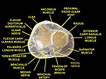 Muscles of upper limb. Cross section.