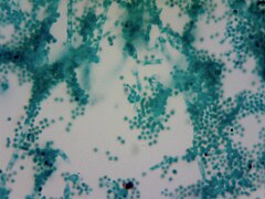 Penicillium spores.jpg