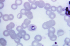 Description de l'image Plasmodium_ovale_01.png.