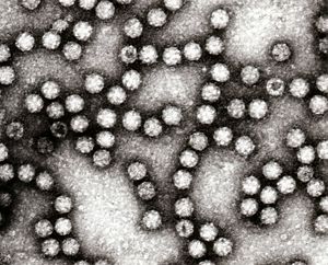 아스트로바이러스의 투과전자현미경 사진