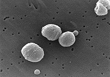 Streptococcus pneumoniae, jeden z původců zápalu plic