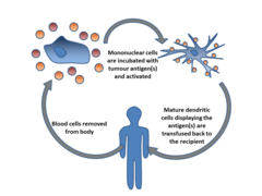 Dendritic cell therapy.png